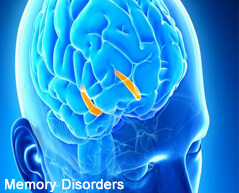 brain memory disorder