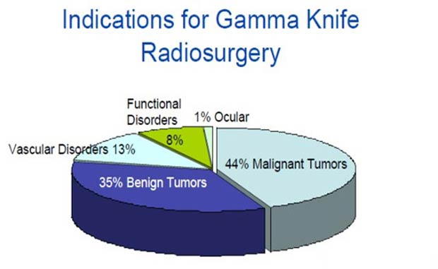 أعلى المستشفيات غاما سكين علاج جراحة الراديو في الهند
