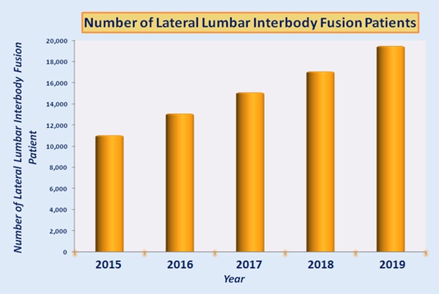 Fusion latérale lombaire-intersomatique