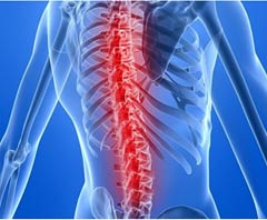 Top Hospitals Spinal Fusion Surgery in India