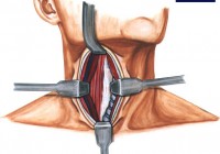Cervical Spine Surgery in India