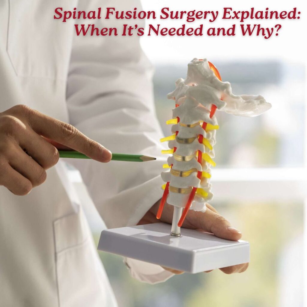 Spinal Fusion Surgery