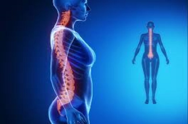 scoliosis treatment