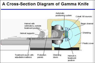 Gamma Knife Cross Section Image