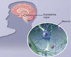 brain parkinson s disease