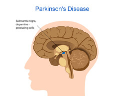 brain parkinson s disease
