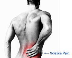 Sciatica surgery in india