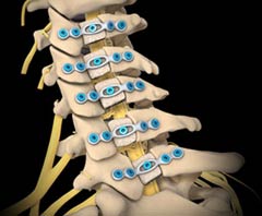 Best Hospital for Cervical Laminoplasty Surgery Treatment India