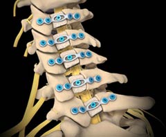 Meilleur hôpital pour le traitement de la plastie cervicale en Inde