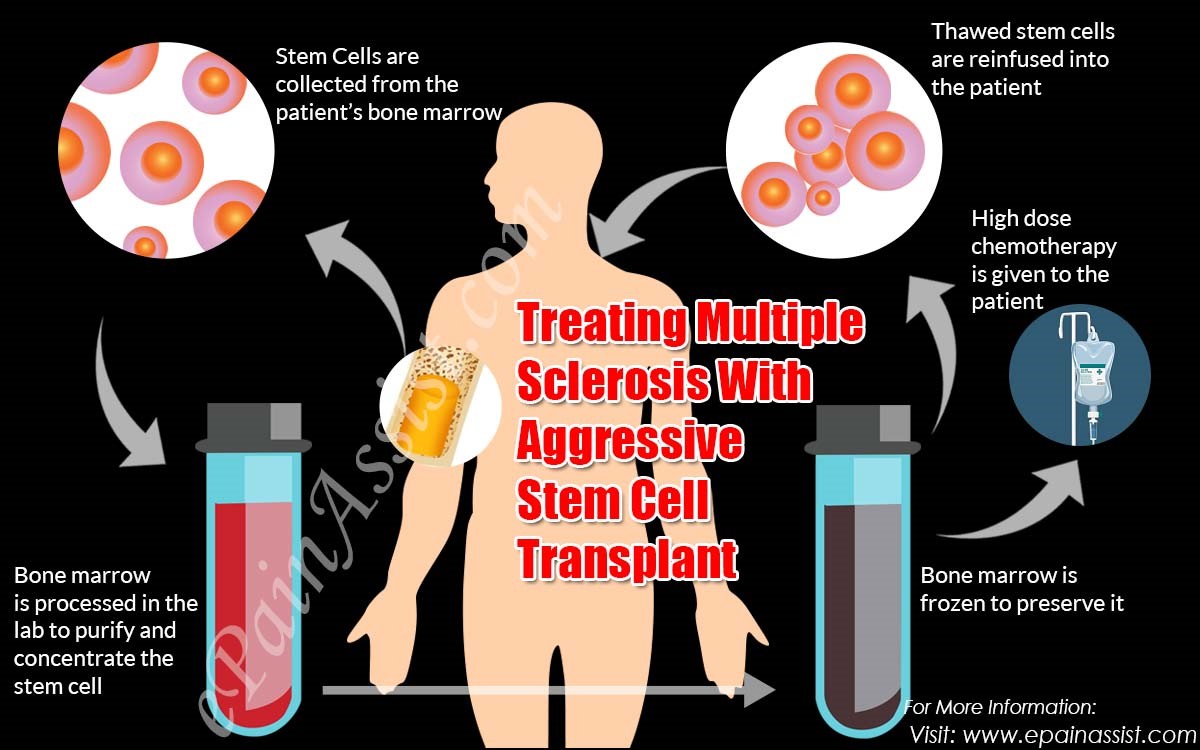 Evaluation Tests before HSCT