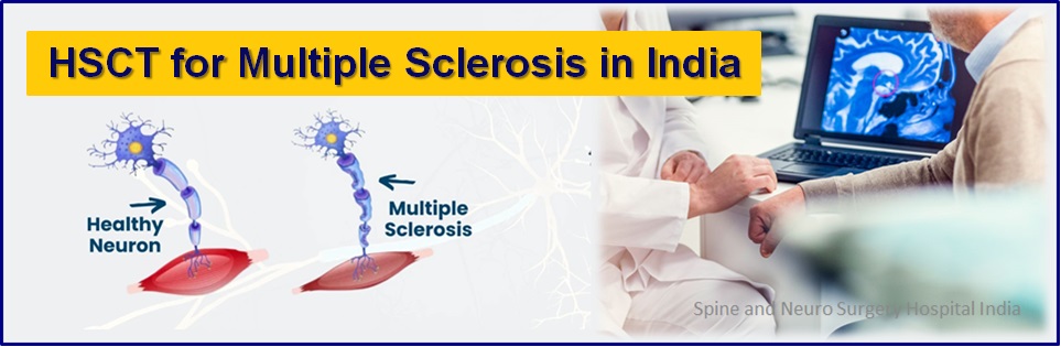 Multiple Sclerosis Treatment Stem Cell