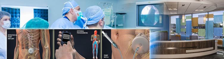 cost of baclofen pump