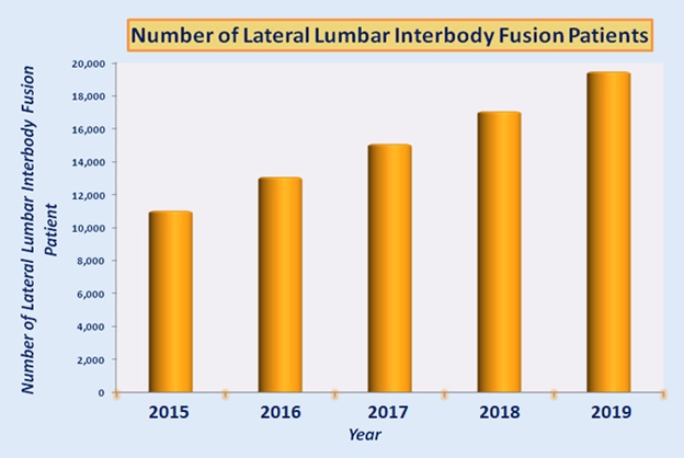 الجانبي Lumbar-Interbody فيوجن